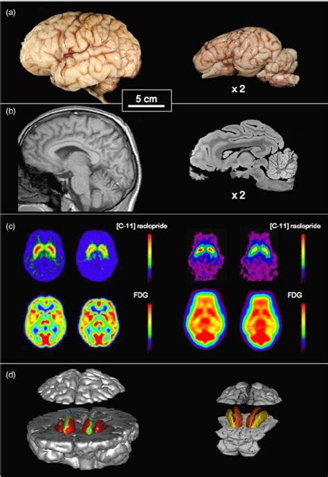 are pig brain similar to human